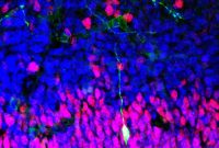 Stem Cell Therapy for Brain Injury Recovery