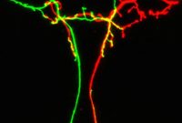 Study Uncovers Mechanism Behind Complex Brain Wiring