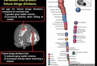 Researchers Pinpoint Risk Factors for Teen Binge Drinking