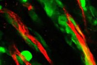 Brain Tumor Spread Along Blood Vessels Could Unlock Treatments