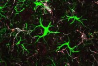 Huntington’s Disease Protein Shapes Developing Brain Wiring