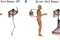Neural Computer Bypass Sends Brain Signals to Legs