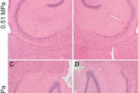 Noninvasive Technique Controls Molecule Size to Cross the BBB