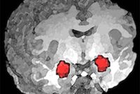 Maturing Brain Reverses Amygdala Role in Stress Hormones