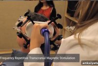 Study Shows Brain Stimulation Improves Memory