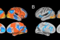 Study Finds Neural Compensation Linked to Alzheimer’s Protein