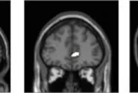 Study Finds Gray Matter Differences in Media Multitaskers
