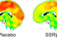 Escitalopram Alters Brain Connectivity Within Hours