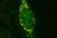 Proteomics in Parkinson’s Disease: Biomarkers and Targets