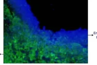 Engineered Stem Cells Secreting Toxins Target Brain Tumors