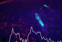 Real-Time Monitoring of Neurochemical Activity in the Brain