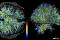 Where Brain Plasticity Shifts in Older Adults