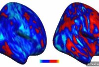 Study Finds Distinct Brain Patterns in Autism