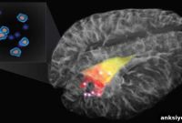 New Imaging Probe Pinpoints Cancer Cells