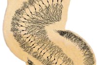 Human Neural Stem Cells Restore Cognition After Chemotherapy