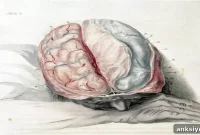 How Neurons Trigger Sleepwalking