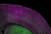 New Brain Circuit May Reveal How Antipsychotics Work