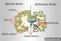 Simple Blood Test Detects Early Alzheimer’s