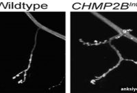 New Mechanism Behind Frontotemporal Dementia Progression