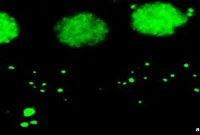 Are You Genetically Susceptible to Noise-Induced Hearing Loss?