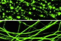 Key Pathway Driving Neuron Death Could Unlock New Treatments