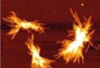 New Regulator Halts Protein Aggregates in Huntington’s Disease