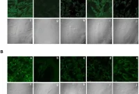 Study Stops Amyloid-Beta Production in Alzheimer’s Mouse Model
