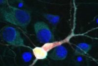 Researchers Identify Promising Drug Target for ALS