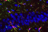 Study Finds Low Glycemic Diet Reduces Autism Symptoms in Mice