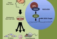 Scientists Disrupt Brain Tumor Stem Cells, Point to New Therapy