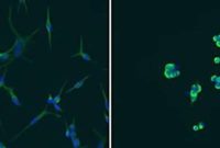 Glioblastoma: How Epigenetic Changes Drive Treatment Resistance