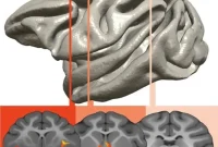 How Children Inherit Anxiety from Their Parents