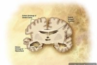 Which Cardiovascular Risk Factors Predict Alzheimer’s Disease?