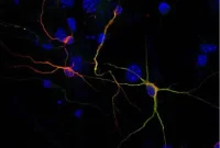 Chemical-Only Reprogramming Turns Human, Mouse Skin into Neurons