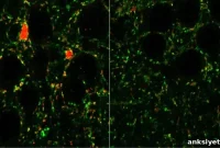 Distinct Inhibitory Neurons Linked to Autism and Schizophrenia