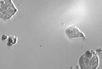 Optogenetic Control of Embryonic Stem Cell Differentiation
