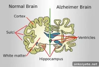 Gene Therapy Restores Neuron Growth and Function in Alzheimer’s