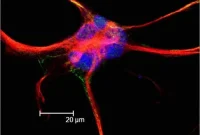 Could Uric Acid Protect Against Parkinson’s Disease?