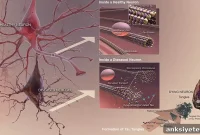 Study: Tau Protein Linked to Diabetes, Separate From Alzheimer’s