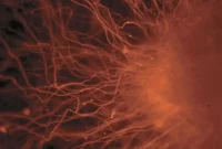 Stem Cell Mini Brains Reveal Drug Candidate for Rare Disease
