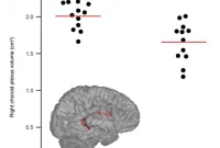 Study Finds Choroid Plexus Role in Chronic Pain