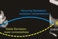 Brain MRI Predicts Risk of Major Depressive Disorder