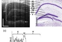 Noninvasive Brain Imaging Reveals Deeper Living Brain Activity