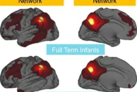 Preterm Birth Linked to Weaker Brain Connections in Infants