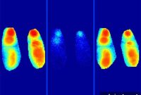How Alzheimer’s Plaques Disrupt Memory Consolidation During Sleep