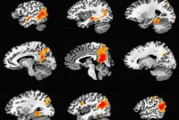 How the Brain Creates Lasting Memories