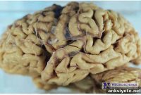 Memory Complaints in Older Women Predict Later Cognitive Decline
