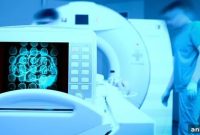 AI-Powered MRI Mapping for Brain Tumors