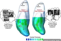 Brain Gray Matter Thickness Predicts Face and Object Recognition