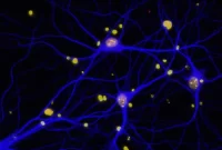 Study: BRCA1 Gene Linked to Alzheimer’s Cognitive Decline